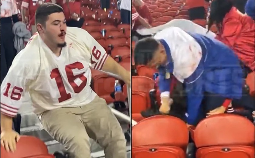 49ers Fans Bloodied In Wild Fight With Giants Supporters After